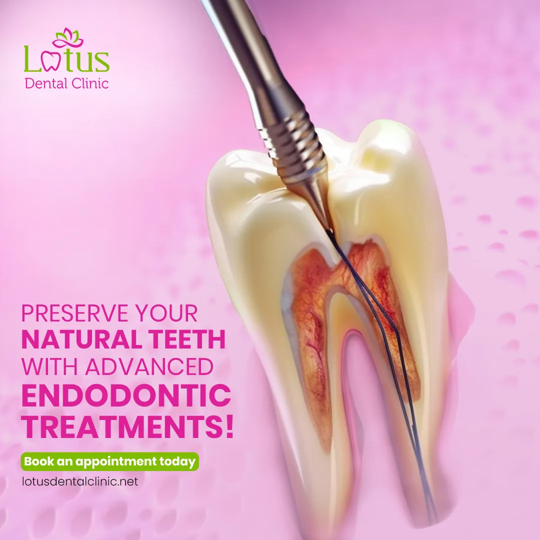 Published work from the Lotus Dental Clinic project, 1 of 5.
